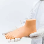 Is-Acupuncture-Helpful-for-Hot-Flashes