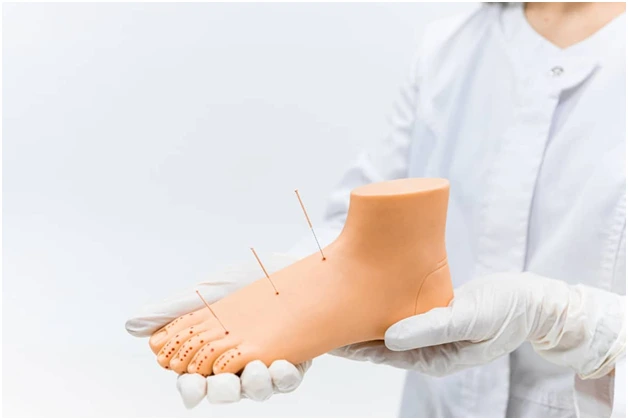 Is-Acupuncture-Helpful-for-Hot-Flashes